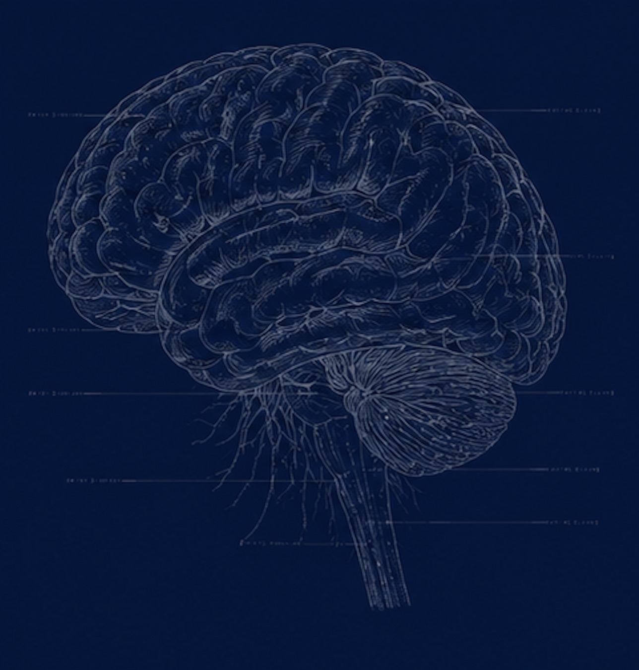 Lateral view of the brain — volumetric imaging
